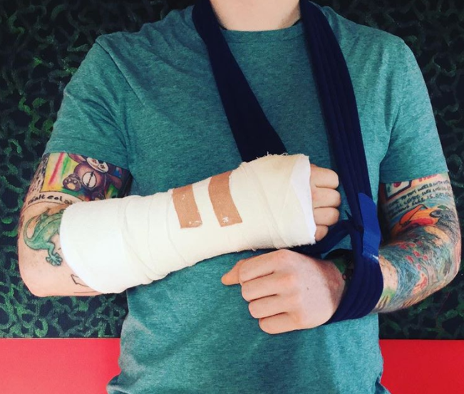 Ed Sheeran Breaks Guitar-Playing Arm, Asia Tour May Be Affected - WORLD OF BUZZ
