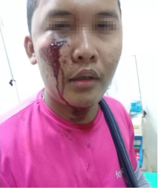 Foodpanda Rider Kicked Off His Bike and Punched in the Face by Angry Road Bully - WORLD OF BUZZ 2