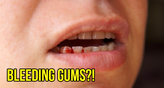 Here's What Can Happen If You're Someone Who Doesn't Like Brushing Your Teeth - WORLD OF BUZZ 15
