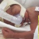M'Sian Doctor Delivers Premature Baby In Japan, Now Needs Rm950,000 For Medical Bill - World Of Buzz