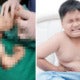 M'Sian Doctors Removed Young Boy'S Unborn Twin In His Body After 15 Years - World Of Buzz 1