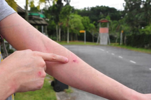 M'sian Wins Fight with Armed Robber After Getting Ambushed in Front of His House - WORLD OF BUZZ 2