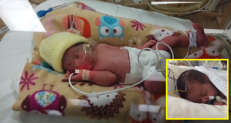 premature msian baby born in uk needs more than rm500000 for treatment world of buzz 6