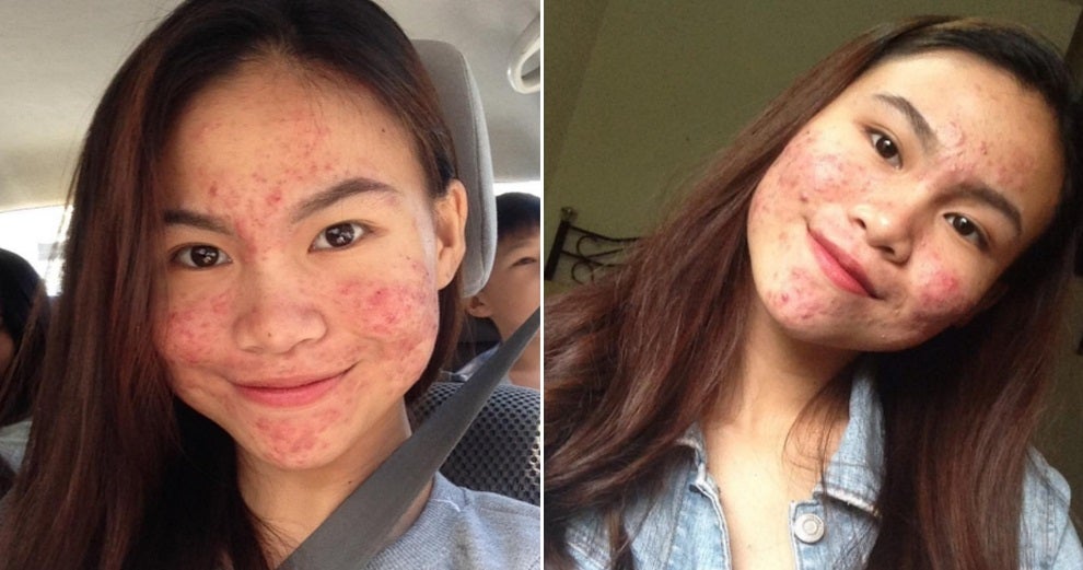 This Insta-Famous Malaysian Is Inspiring Everyone With Her Natural Skin - World Of Buzz 9