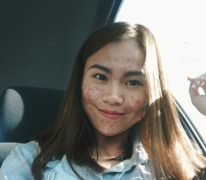 This Insta-Famous Malaysian Is Inspiring Everyone With Her Natural Skin - World Of Buzz 8