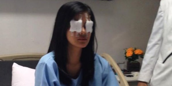 Woman Kicks KTV Hostess in the Face with High Heel, Becomes Blind After Left Eyeball Pops Out - WORLD OF BUZZ 2