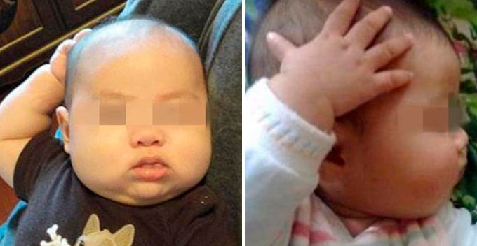 1Yo Baby Keeps Touching Head And Parents Think Its Normal Turns Out It Wasnt World Of Buzz 1