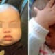 1Yo Baby Keeps Touching Head And Parents Think It'S Normal, Turns Out It Wasn'T - World Of Buzz