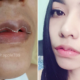 Goodbye Kylie Jenner Lips, Asian People Are Now Getting Lip Reduction Surgeries - World Of Buzz