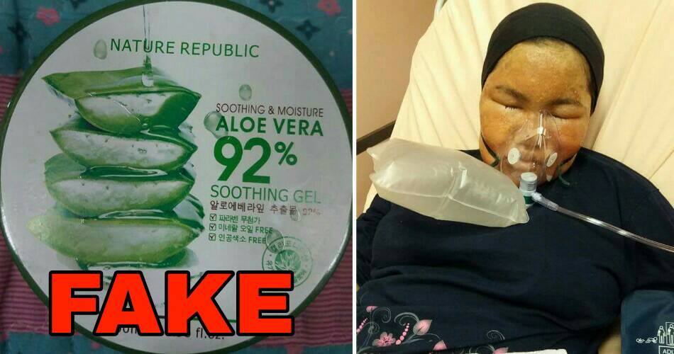 malaysian lady rushed to emergency ward after using fake nature republic aloe vera soothing gel world of buzz 2