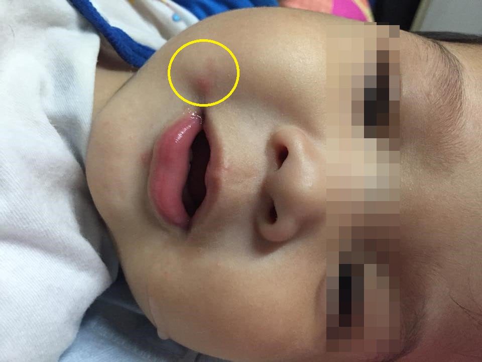 M'sian Mother Shares How Child Contracted Hand, Foot &Amp; Mouth Disease From Dirty Chair - World Of Buzz 1