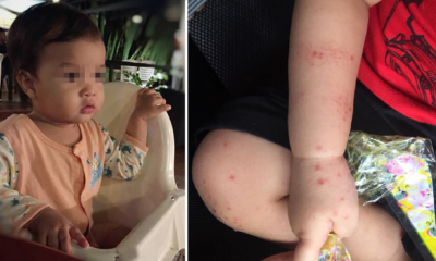 M'Sian Mother Shares How Child Contracted Hand, Foot &Amp; Mouth Disease From Dirty Chair - World Of Buzz 3