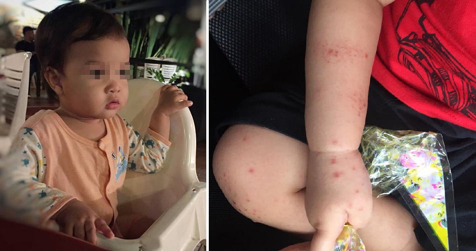 M'Sian Mother Shares How Child Contracted Hand, Foot &Amp; Mouth Disease From Dirty Chair - World Of Buzz 3