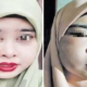 M'Sian Woman Suffers From Swollen, Painful Face After Using Online Beauty Product - World Of Buzz 4