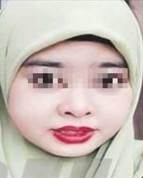 M'sian Woman Suffers From Swollen, Painful Face After Using Online Beauty Product - World Of Buzz
