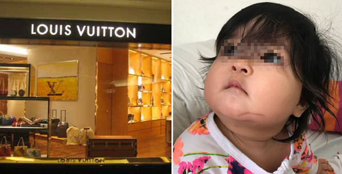 Singer To Sue Lv Store In Gardens Mall For Causing 2Nd Degree Burns On Baby - World Of Buzz 1