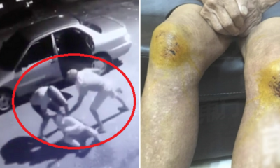 Three Elderly Folks Brutally Beaten Up And Robbed When Going For Morning Walk - World Of Buzz 3