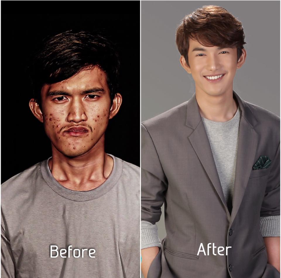 'Ugly' Thai Man Goes Through Plastic Surgery, Mother Couldn't Even Recognise Him - WORLD OF BUZZ 4