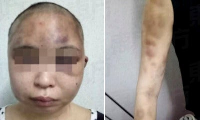 Wife'S Head Shaved And Bashed After Husband Suspected Her For Having An Affair - World Of Buzz