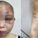 Wife'S Head Shaved And Bashed After Husband Suspected Her For Having An Affair - World Of Buzz