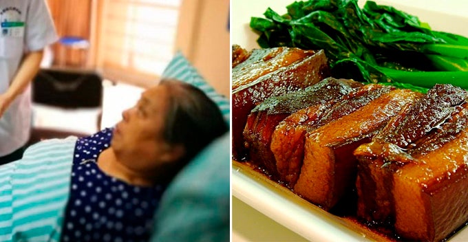 woman eats fatty pork and lard for every meal 806 gallstones found in her body world of buzz