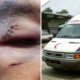 Ambulance Driver And Nurse Get Beaten Up After Asking Mat Rempitto Give Way - World Of Buzz