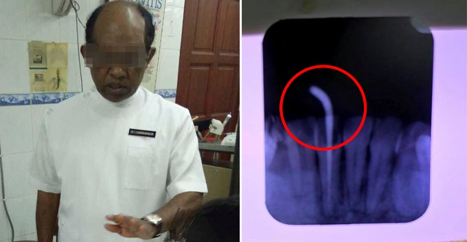 Lady Gets Braces at Ampang Clinic, Ends Up with Horrible Infection and Damaged Roots - WORLD OF BUZZ