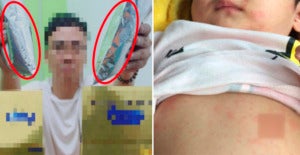 M'sian Baby Gets Admitted To Hospital For High Fever And Rashes After Drinking Fake Milk Powder - World Of Buzz