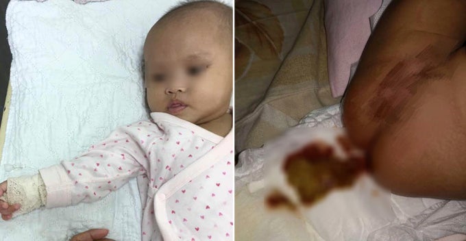 M'sian Baby Passes Out Bloody Stool After Allegedly Consumes Fake Milk Powder - World Of Buzz
