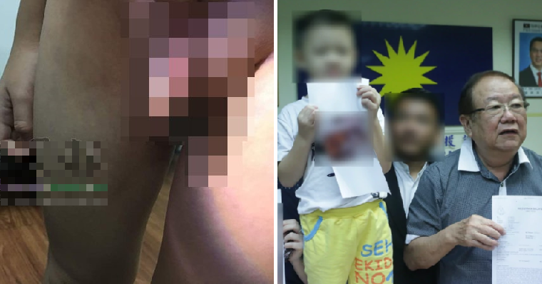 Sg Buloh Teacher Accused Of Pinching 4Yo Boy'S Genitals Because He Refused To Nap - World Of Buzz 5