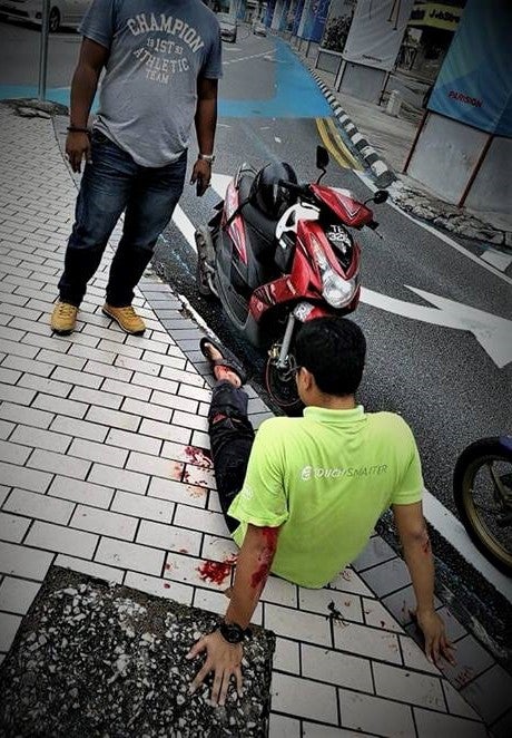 DBKL Take Down Dangerous Bicycle Lane Separators From Roads After Motorists Sustain Injuries - WORLD OF BUZZ 2