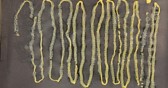 Man Passes Out 2.8M-Long Tapeworm from Rectum, Had Absolutely No Idea It Was Inside - WORLD OF BUZZ 2