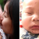 Mother Warns Others Not To Simply Kiss Babies After Son Contracts Terrible Rash - World Of Buzz 2