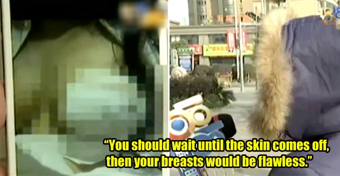 Woman Loses Nipples After Breast Augmentation, Surgeon Shockingly Exposed As Dentist - World Of Buzz 1