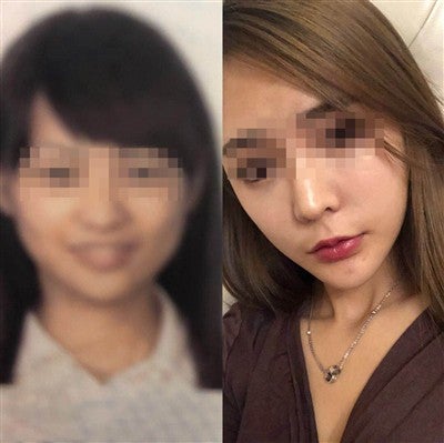 Woman Misses Flight After Security Scanner Couldn't Recognise Her Post-Plastic Surgery Face - WORLD OF BUZZ