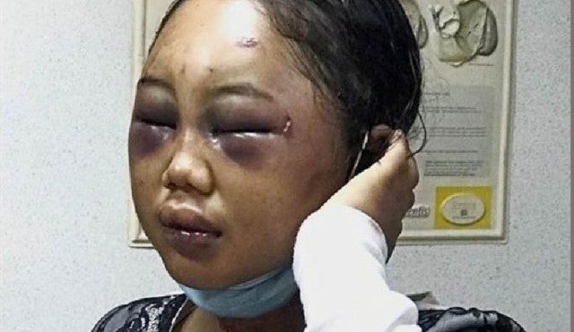 Datin Who Ruthlessly Abused Maid Escapes Jail Time Because She Has Repented - WORLD OF BUZZ 1