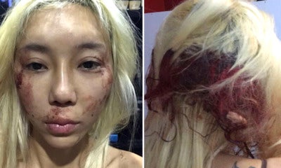 Famous Dj Leng Yein Exposes Her Abusive Ex In Disturbing Facebook Live Video - World Of Buzz