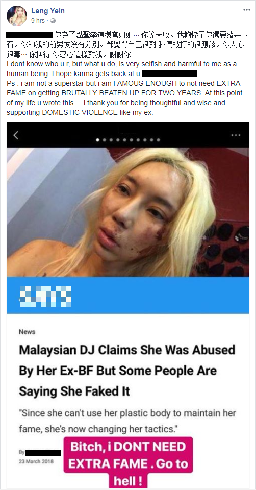 Famous M'sian Dj Bravely Breaks Silence Against Domestic Violence But Haters Still Thinks It's Fake - World Of Buzz