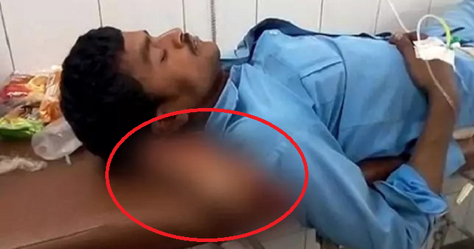 Medical Staff Absurdly Used Man'S Severed Amputated Leg As A Pillow - World Of Buzz