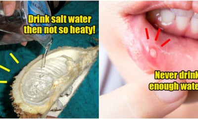 Ulcers = “Yeet Hei”, And X Other M'Sian Old Wives Tales That Are Not True - World Of Buzz 6