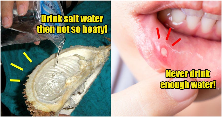 Ulcers = “Yeet Hei”, And X Other M'Sian Old Wives Tales That Are Not True - World Of Buzz 6