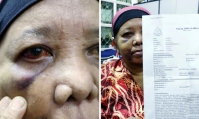 62Yo Maid Climbs 2M Wall To Escape Employer Who Brutally Abused Her Until She Lost Her Hearing - World Of Buzz 4