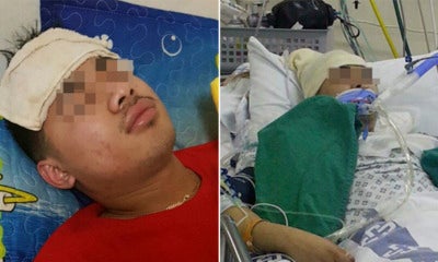 Healthy Young Man Suffered From Headache And Fever, Died After Two Weeks - World Of Buzz