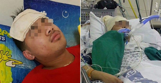 Healthy Young Man Suffered From Headache and Fever, Died After Two Weeks - WORLD OF BUZZ
