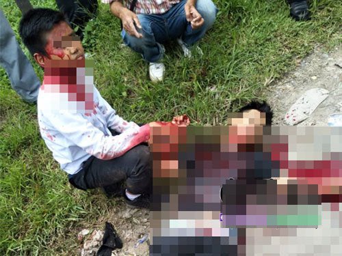 Malaysian's Neck Nearly Decapitated After Asking Friend To Return Rm300 - World Of Buzz