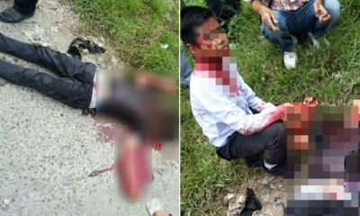 M'Sian Man Nearly Decapitated After Asking Friend To Return Rm300 - World Of Buzz 1
