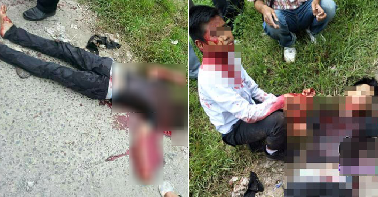 M'sian Man Nearly Decapitated After Asking Friend to Return RM300 - WORLD OF BUZZ 1