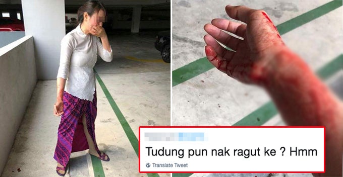 Malindo Air Crew Injured at Parking Lot Robbery, Salty Netizens Focus on Her Uniform Instead - WORLD OF BUZZ 1