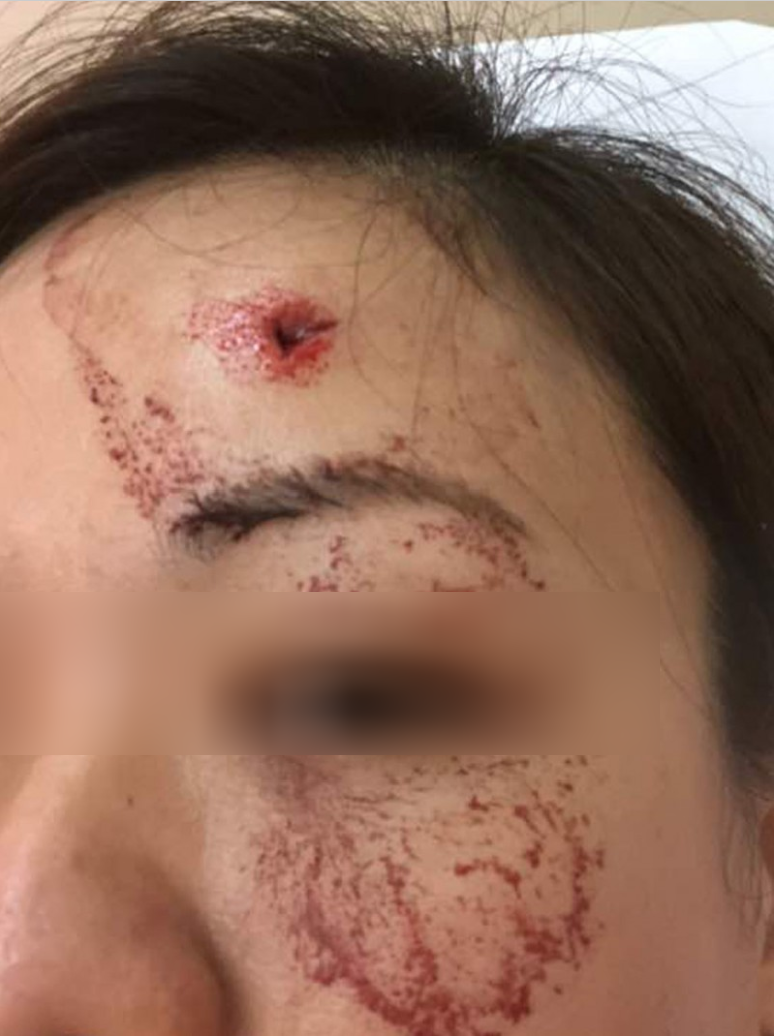 M'sian Lady Gets Injured By 3-Foot Long Iron Rod Which Pierced Her Car On Nkve - World Of Buzz