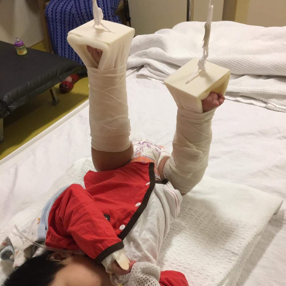 Parents Shocked to Find Their Baby With Broken Thigh Bone While Allegedly Under Babysitter's Care - WORLD OF BUZZ